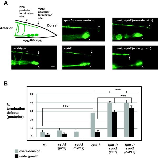 https://cdn.ncbi.nlm.nih.gov/pmc/blobs/1717/4077836/603a65cb44e5/1749-8104-9-10-2.jpg