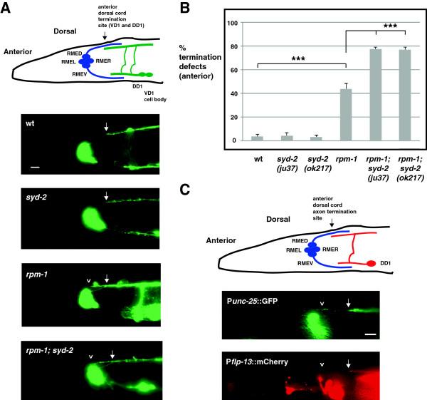 https://cdn.ncbi.nlm.nih.gov/pmc/blobs/1717/4077836/bbf1b51db2eb/1749-8104-9-10-3.jpg