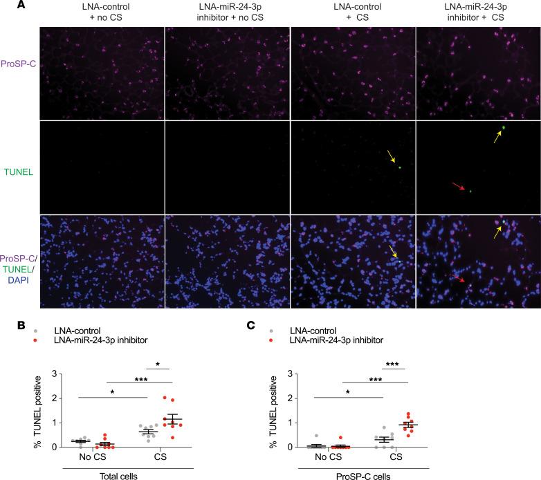 https://cdn.ncbi.nlm.nih.gov/pmc/blobs/171f/7934877/67e75a6947d3/jciinsight-6-134218-g051.jpg