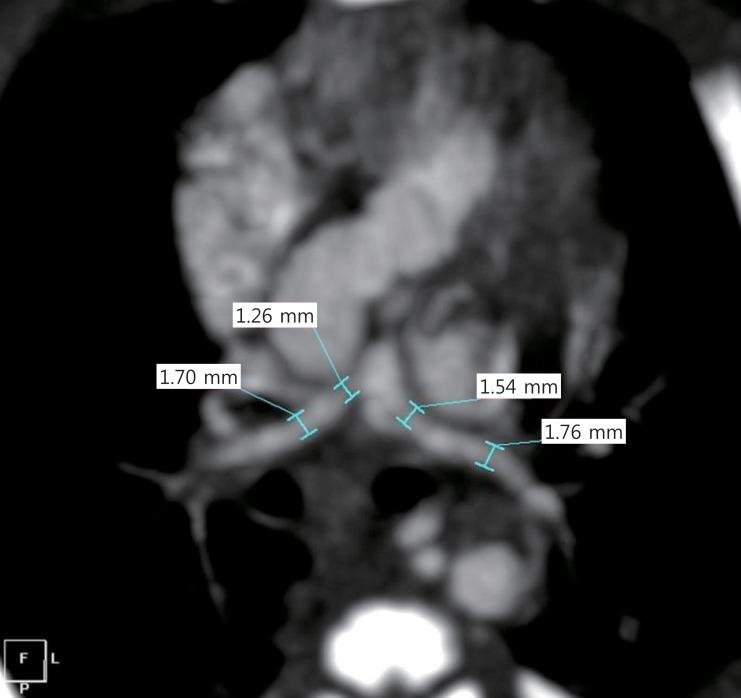 https://cdn.ncbi.nlm.nih.gov/pmc/blobs/1721/3935108/82b14370afca/kjped-57-19-g002.jpg