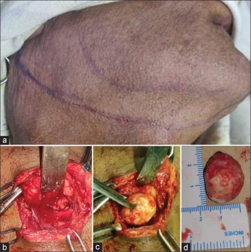 https://cdn.ncbi.nlm.nih.gov/pmc/blobs/172b/12469081/0e10cdfaf9dd/NJMS-16-388-g003.jpg
