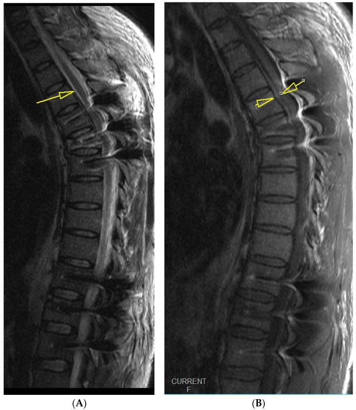 https://cdn.ncbi.nlm.nih.gov/pmc/blobs/1735/10534765/639196b88d99/medicina-59-01590-g005.jpg