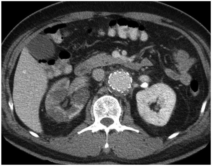 https://cdn.ncbi.nlm.nih.gov/pmc/blobs/1738/6658877/6cc87849e0c4/kjr-20-1247-g010.jpg
