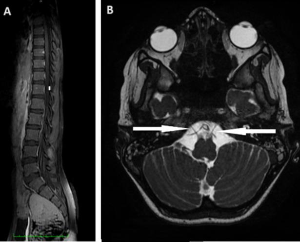 https://cdn.ncbi.nlm.nih.gov/pmc/blobs/1740/11161700/366192b08fe1/PAMJ-47-127-g001.jpg