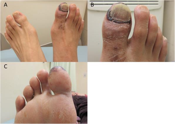 https://cdn.ncbi.nlm.nih.gov/pmc/blobs/1741/7520864/0db3ef969d98/42155_2020_166_Fig1_HTML.jpg