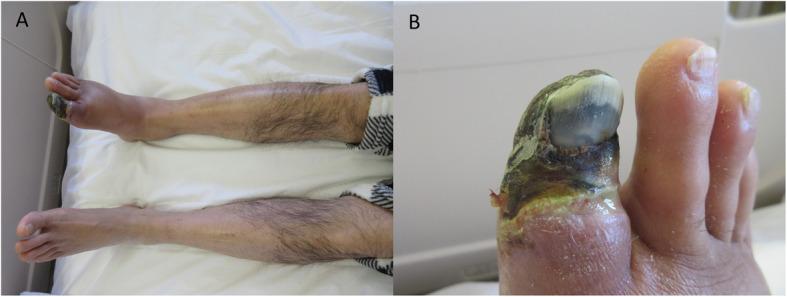 https://cdn.ncbi.nlm.nih.gov/pmc/blobs/1741/7520864/d037898b5195/42155_2020_166_Fig3_HTML.jpg