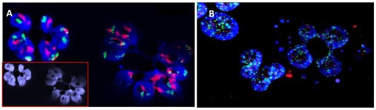 https://cdn.ncbi.nlm.nih.gov/pmc/blobs/1745/5923346/bdf9e2837008/cancers-10-00091-g002.jpg