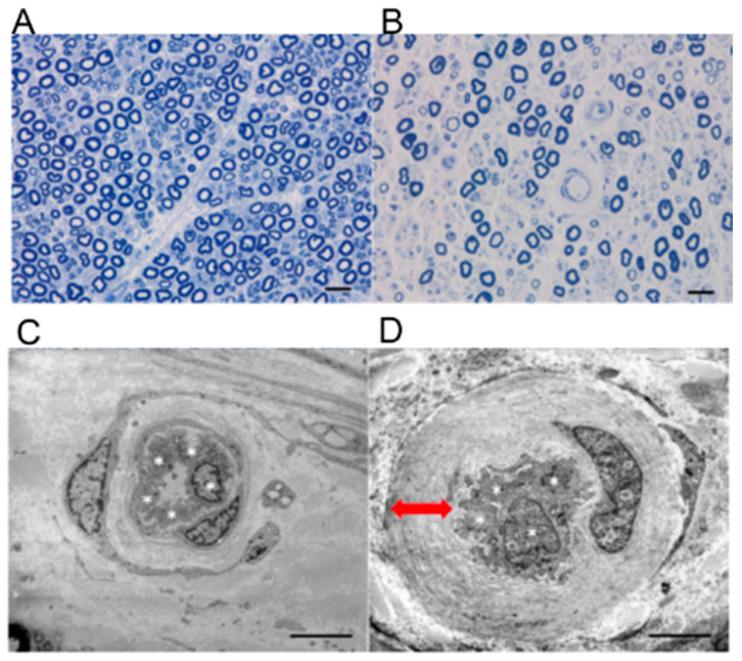 https://cdn.ncbi.nlm.nih.gov/pmc/blobs/174d/7793499/3406572416d6/ijms-22-00062-g005.jpg