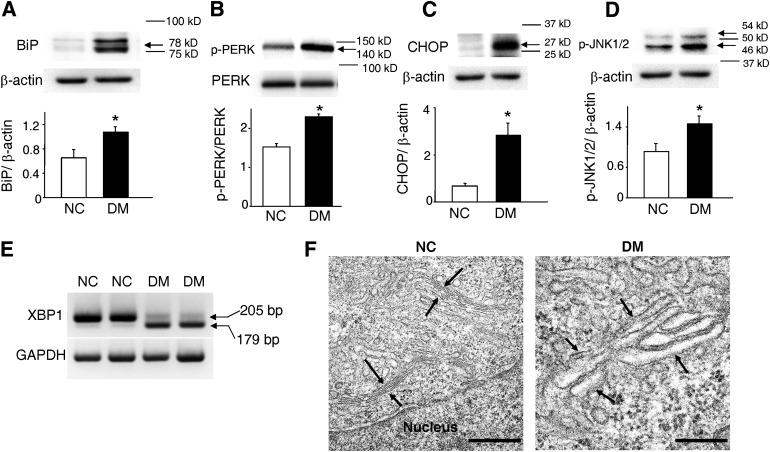 https://cdn.ncbi.nlm.nih.gov/pmc/blobs/174f/3554374/7c165af0a518/599fig1.jpg