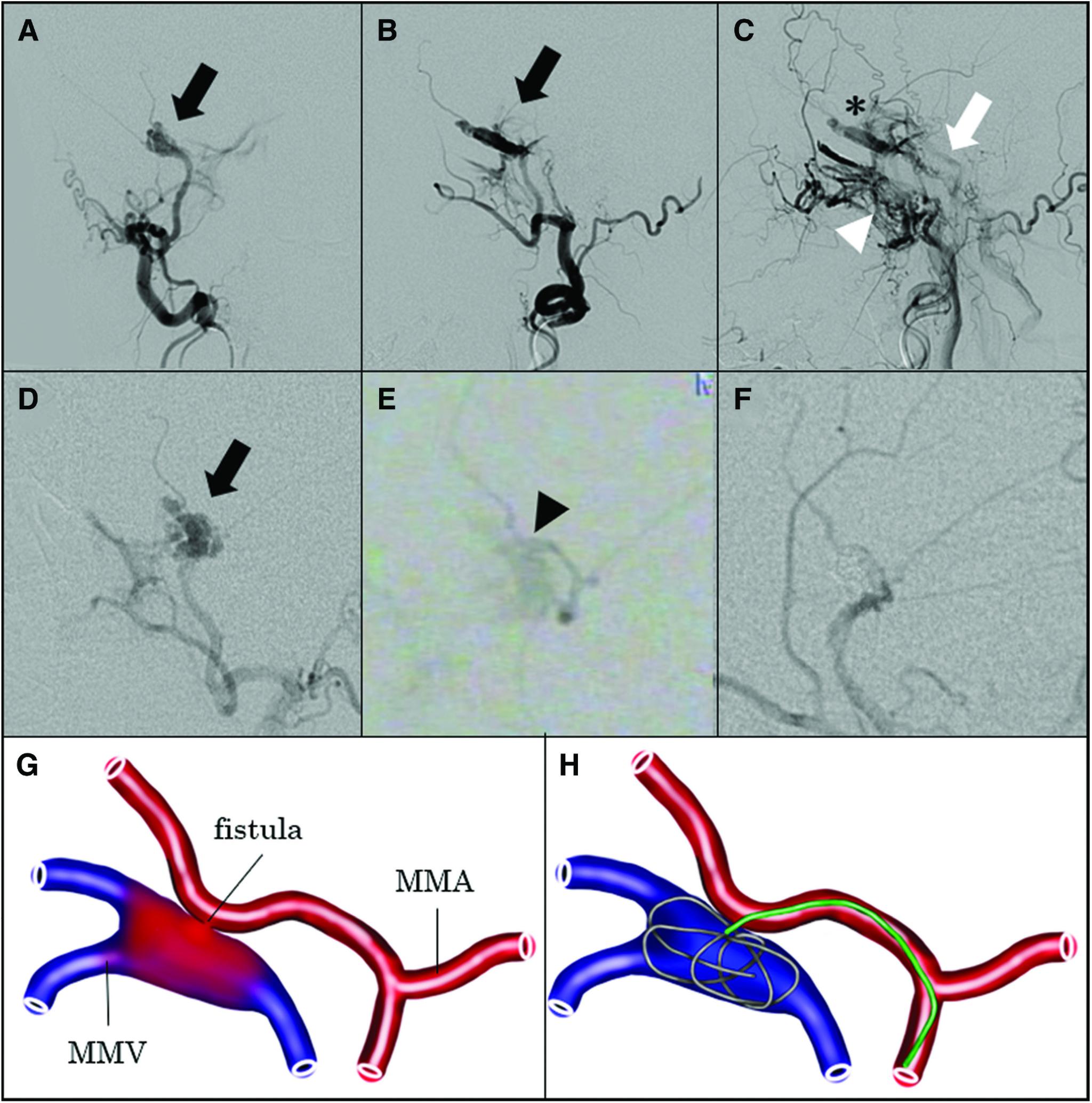 https://cdn.ncbi.nlm.nih.gov/pmc/blobs/1753/10370967/b4c87e59f645/jnet-16-100-g002.jpg
