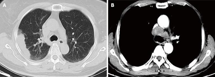 https://cdn.ncbi.nlm.nih.gov/pmc/blobs/1756/8567515/0a2ef3a40e18/WJCC-9-9236-g001.jpg