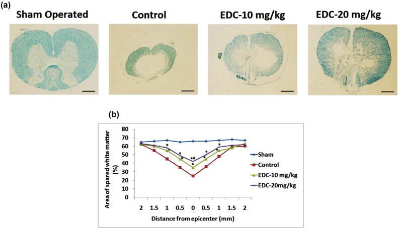 https://cdn.ncbi.nlm.nih.gov/pmc/blobs/175a/7917365/914df4e12519/j_tnsci-2020-0128-fig002.jpg