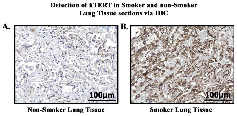 https://cdn.ncbi.nlm.nih.gov/pmc/blobs/175c/11172003/06c0c4e25fb3/cells-13-00884-g009.jpg