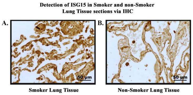 https://cdn.ncbi.nlm.nih.gov/pmc/blobs/175c/11172003/1ee78bd2188f/cells-13-00884-g007.jpg