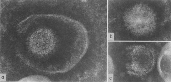 https://cdn.ncbi.nlm.nih.gov/pmc/blobs/1765/2466722/2b1214234bbf/postmedj00366-0010-a.jpg