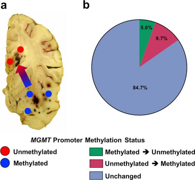 https://cdn.ncbi.nlm.nih.gov/pmc/blobs/1766/11252228/95bd807ff84d/401_2024_2761_Fig4_HTML.jpg