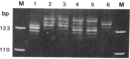 https://cdn.ncbi.nlm.nih.gov/pmc/blobs/1768/1682649/4616c1614c91/ajhg00075-0220-c.jpg
