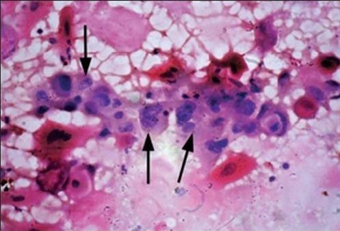 https://cdn.ncbi.nlm.nih.gov/pmc/blobs/176d/4124542/787d965be50b/NMJ-55-299-g006.jpg