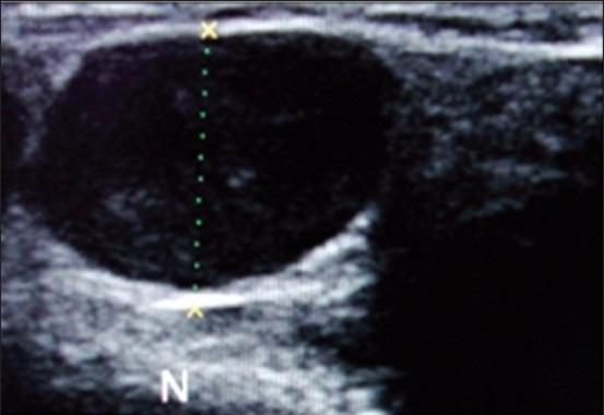https://cdn.ncbi.nlm.nih.gov/pmc/blobs/176d/4124542/df13cf5f20a9/NMJ-55-299-g002.jpg