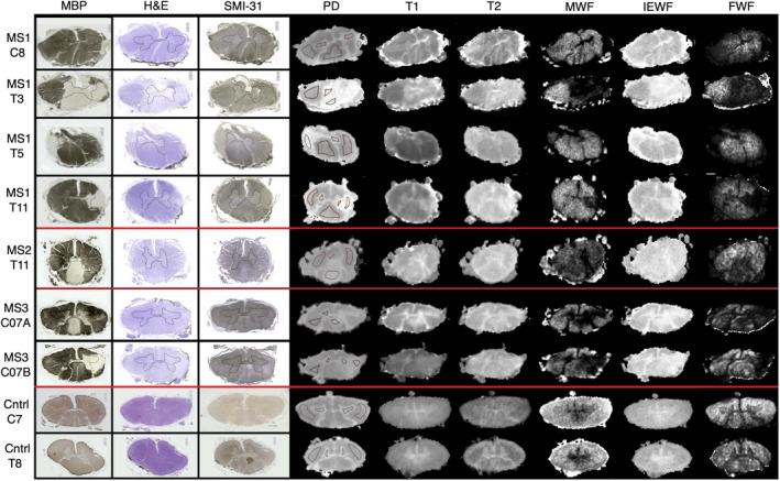 https://cdn.ncbi.nlm.nih.gov/pmc/blobs/176e/9208576/f850831b0bca/MRM-87-2914-g002.jpg