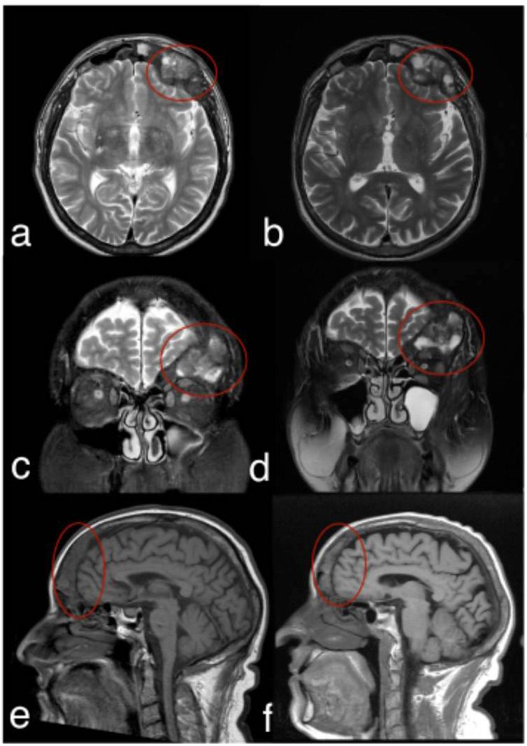 https://cdn.ncbi.nlm.nih.gov/pmc/blobs/1770/12142367/1ba8a6d46424/jced-17-05-e604-g002.jpg