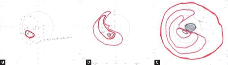 https://cdn.ncbi.nlm.nih.gov/pmc/blobs/1775/10408612/1558c04a223d/SNI-14-245-g005.jpg