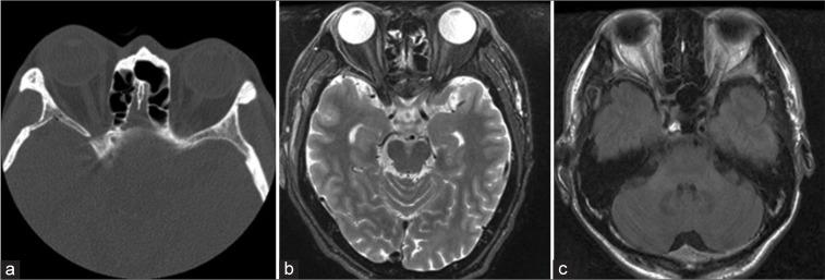 https://cdn.ncbi.nlm.nih.gov/pmc/blobs/1775/10408612/f838d283aa5c/SNI-14-245-g001.jpg
