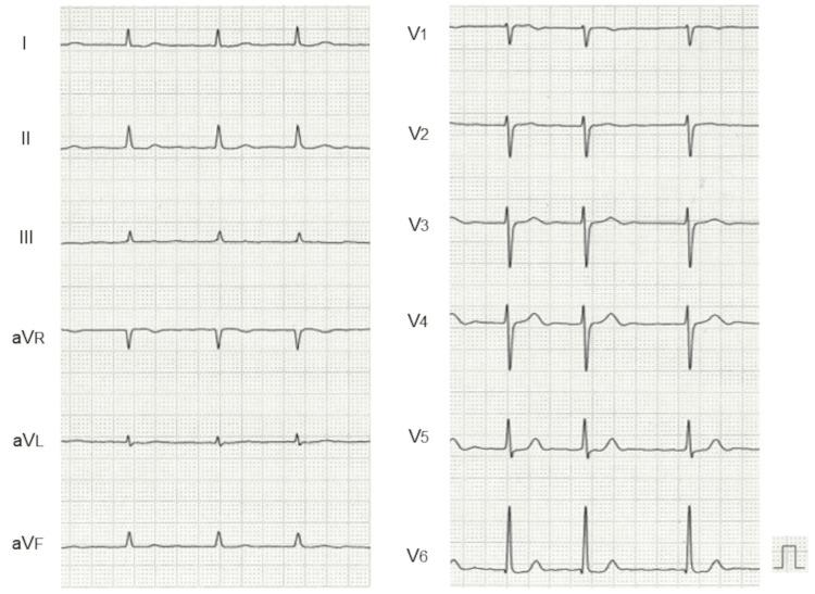 https://cdn.ncbi.nlm.nih.gov/pmc/blobs/1777/11571103/2cf789b939fd/cureus-0016-00000071844-i01.jpg