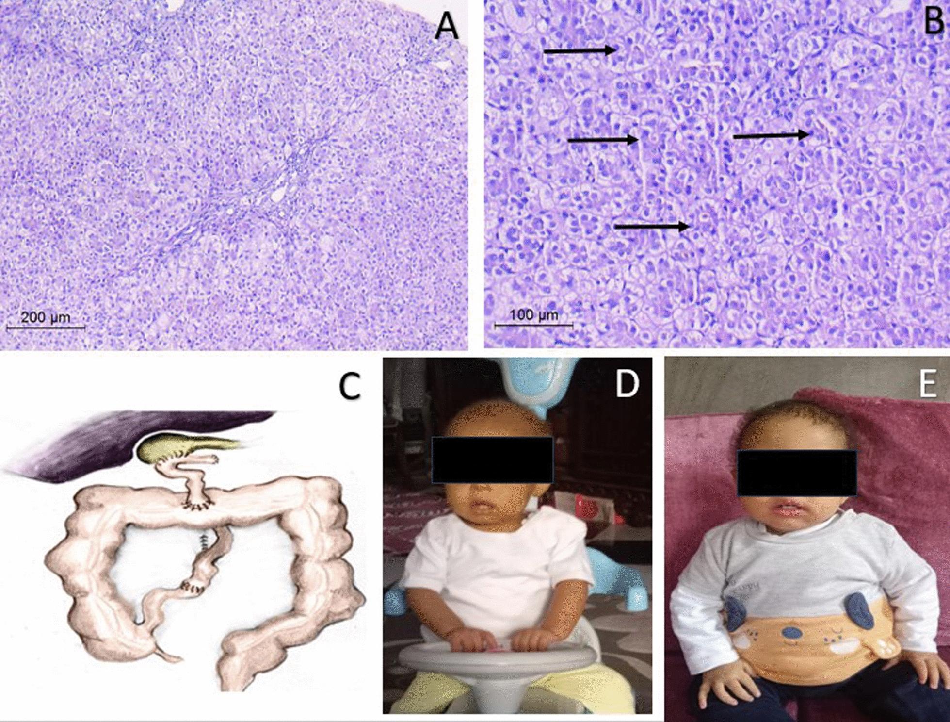 https://cdn.ncbi.nlm.nih.gov/pmc/blobs/177a/11380191/44ef439a2ff1/13256_2024_4662_Fig1_HTML.jpg