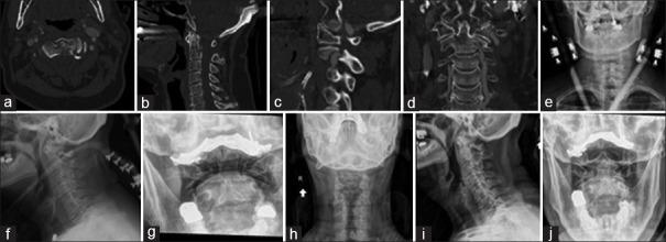 https://cdn.ncbi.nlm.nih.gov/pmc/blobs/177f/12029392/27ee85007215/JCVJS-16-96-g001.jpg