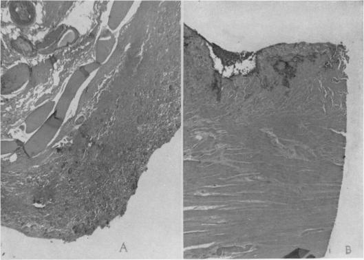 https://cdn.ncbi.nlm.nih.gov/pmc/blobs/1780/1408946/38e1e0af3e83/annsurg00930-0151-a.jpg