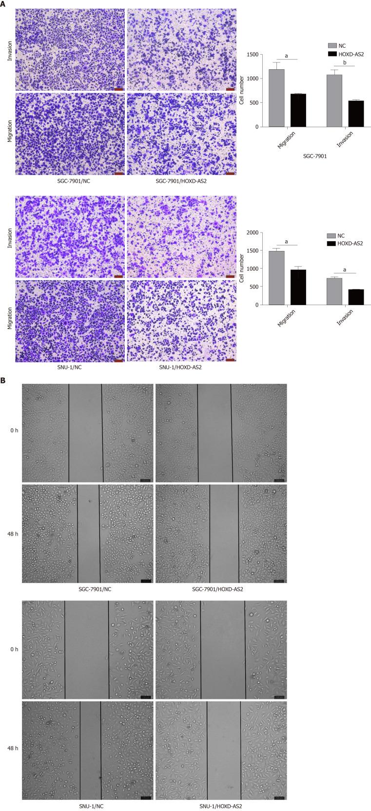 https://cdn.ncbi.nlm.nih.gov/pmc/blobs/1787/7667460/efd9770525d9/WJGO-12-1237-g003.jpg