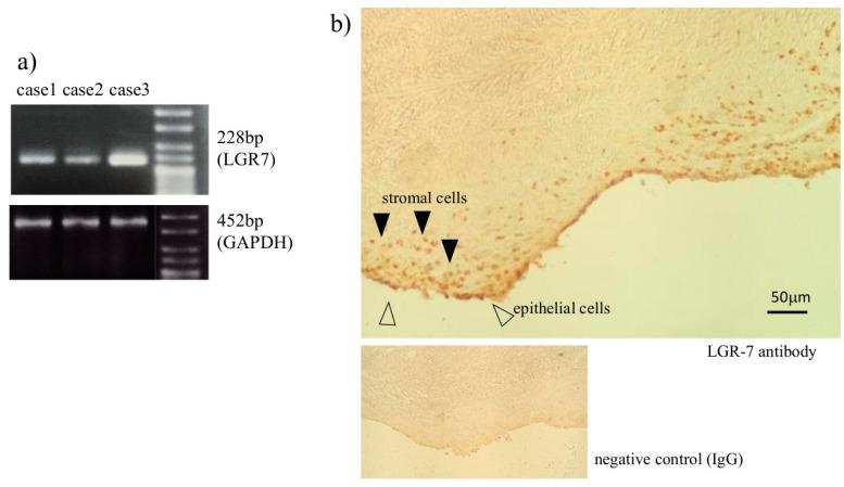https://cdn.ncbi.nlm.nih.gov/pmc/blobs/1789/7693148/f73ac33cb8db/biomedicines-08-00467-g001.jpg