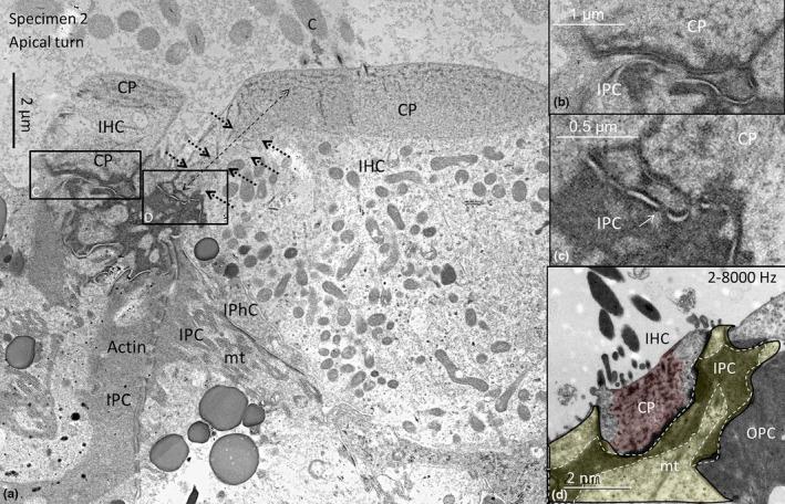 https://cdn.ncbi.nlm.nih.gov/pmc/blobs/178d/11259753/444aa23bb67a/JOA-245-271-g005.jpg