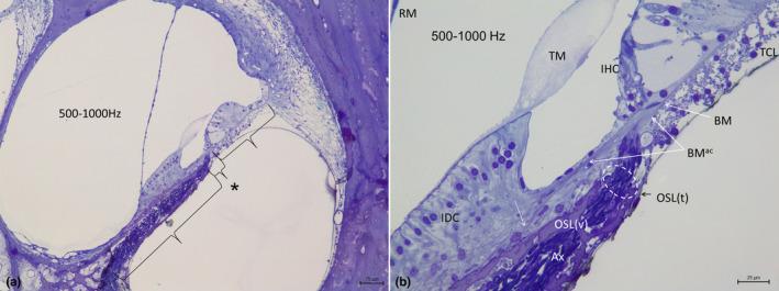 https://cdn.ncbi.nlm.nih.gov/pmc/blobs/178d/11259753/5b73b76a5689/JOA-245-271-g017.jpg