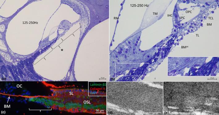 https://cdn.ncbi.nlm.nih.gov/pmc/blobs/178d/11259753/6818e984a3f3/JOA-245-271-g007.jpg