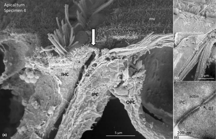 https://cdn.ncbi.nlm.nih.gov/pmc/blobs/178d/11259753/6f63c3dbcb0e/JOA-245-271-g016.jpg