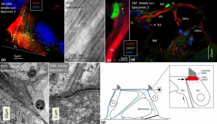https://cdn.ncbi.nlm.nih.gov/pmc/blobs/178d/11259753/dc0204a475c2/JOA-245-271-g003.jpg