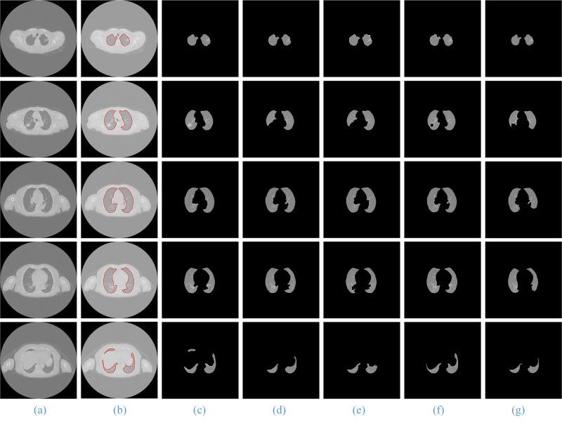 https://cdn.ncbi.nlm.nih.gov/pmc/blobs/1794/4988714/889dcd75d581/pone.0160556.g013.jpg