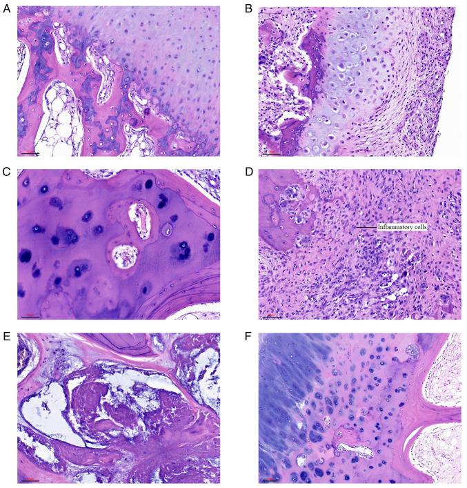 https://cdn.ncbi.nlm.nih.gov/pmc/blobs/1794/9204554/379b6b4e36b0/etm-24-01-11397-g00.jpg