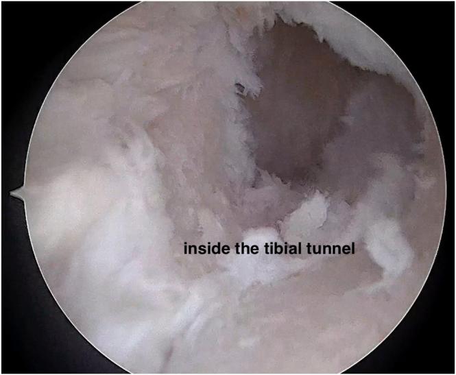https://cdn.ncbi.nlm.nih.gov/pmc/blobs/1796/11704902/71f4acadca9f/gr7.jpg