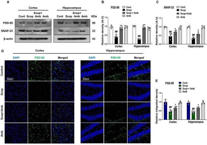 https://cdn.ncbi.nlm.nih.gov/pmc/blobs/179f/12325200/95f0bfcd9507/fnagi-17-1607289-g005.jpg