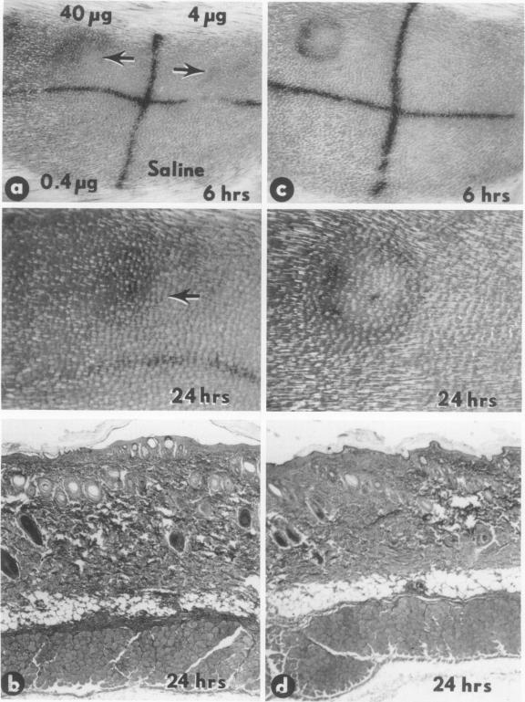 https://cdn.ncbi.nlm.nih.gov/pmc/blobs/17a9/414668/404aa417a74f/iai00191-0286-a.jpg