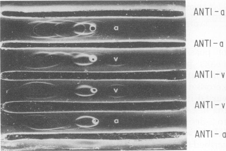 https://cdn.ncbi.nlm.nih.gov/pmc/blobs/17a9/414668/4a7999f8376c/iai00191-0284-b.jpg