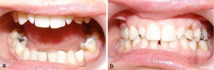 https://cdn.ncbi.nlm.nih.gov/pmc/blobs/17a9/9289691/32b89c06b948/RJME-62-4-1045-fig1.jpg