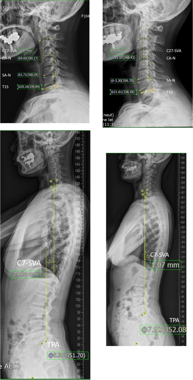 https://cdn.ncbi.nlm.nih.gov/pmc/blobs/17ae/9942978/83d145c13703/pone.0281926.g005.jpg