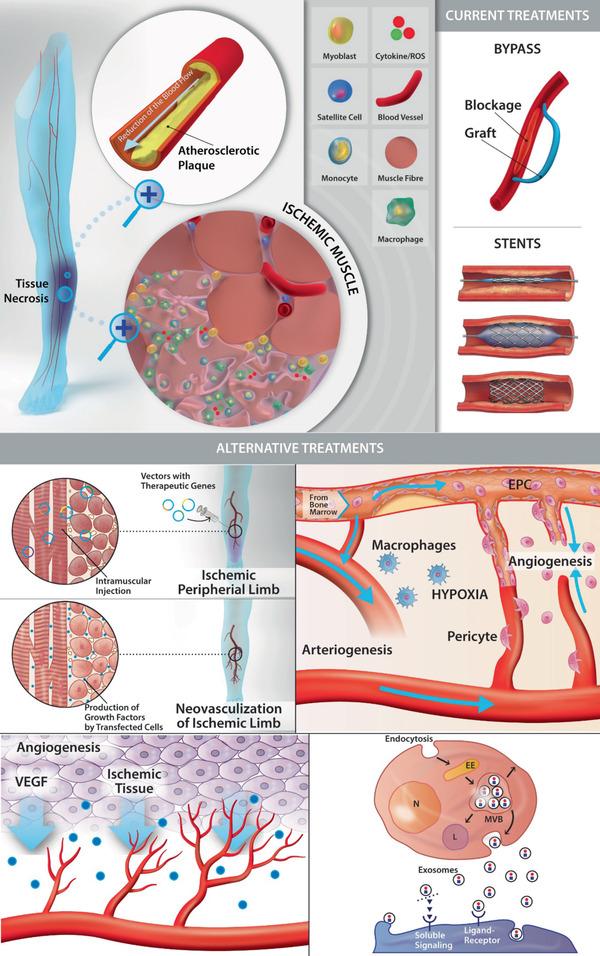 https://cdn.ncbi.nlm.nih.gov/pmc/blobs/17b0/8025020/851601a8e930/ADVS-8-2003119-g005.jpg
