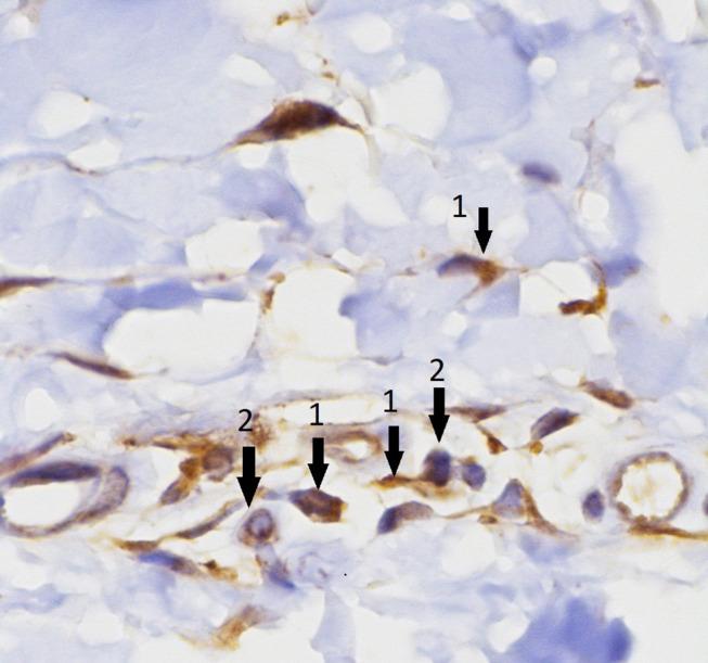 https://cdn.ncbi.nlm.nih.gov/pmc/blobs/17c4/7592154/ba28009b3b8c/ITT-9-217-g0001.jpg