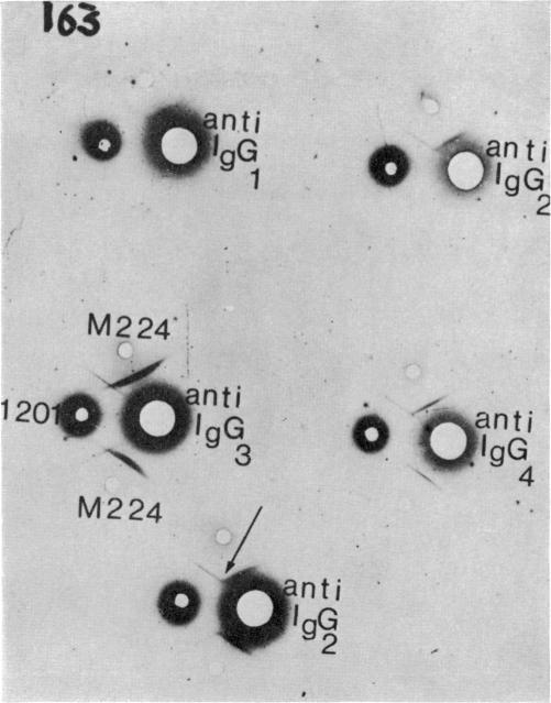 https://cdn.ncbi.nlm.nih.gov/pmc/blobs/17cb/1423058/1b43f429556b/immunology00332-0051-a.jpg