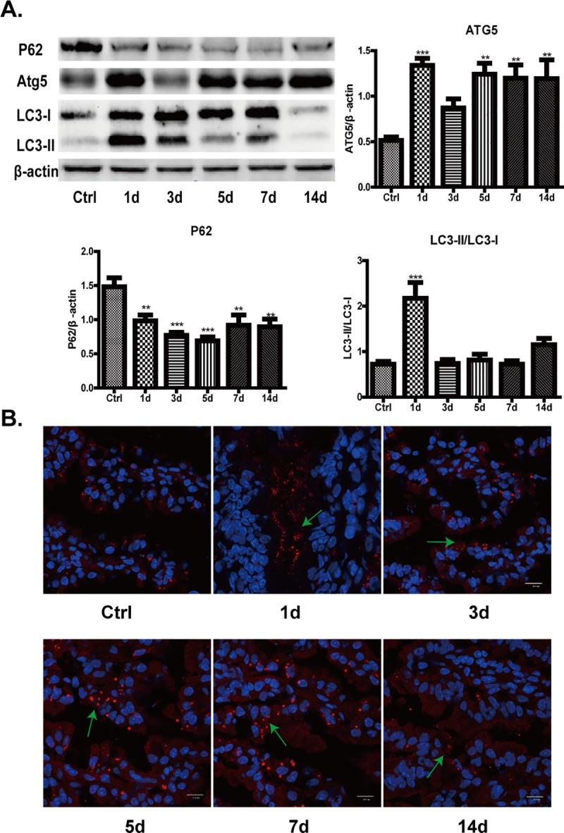 https://cdn.ncbi.nlm.nih.gov/pmc/blobs/17d1/6581431/1132d13380a1/pone.0218384.g007.jpg